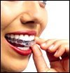 Braces Free Straight Teeth, general and cosmetic dental services